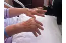 Palindromik Romatizma Belirtileri ve Tedavisi