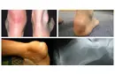 Tendinit Özellikleri ve Faydaları Nelerdir?