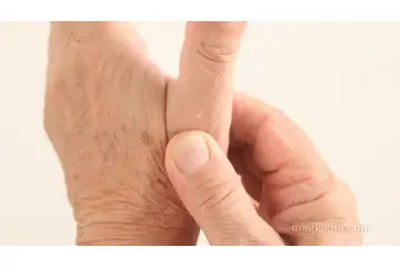 Romatoid Artrit Diyeti Nasıl Yapılır?